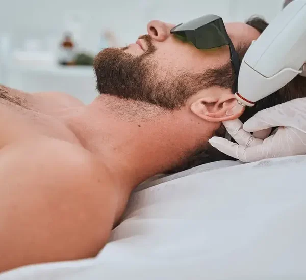 Smooth Moves Your Guide to Professional Laser Hair Removal