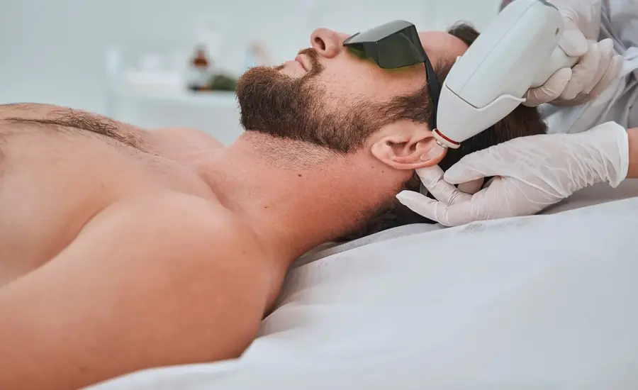 Smooth Moves Your Guide to Professional Laser Hair Removal