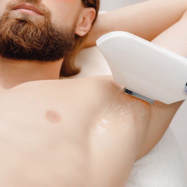 How to Prevent Hair Regrowth After Laser Hair Removal